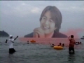 모발이식[본편]