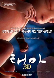 태아 3D
